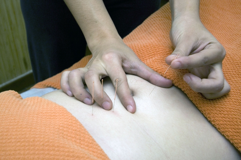 osteopathe-STE AGNES-min_acupuncture-4175625